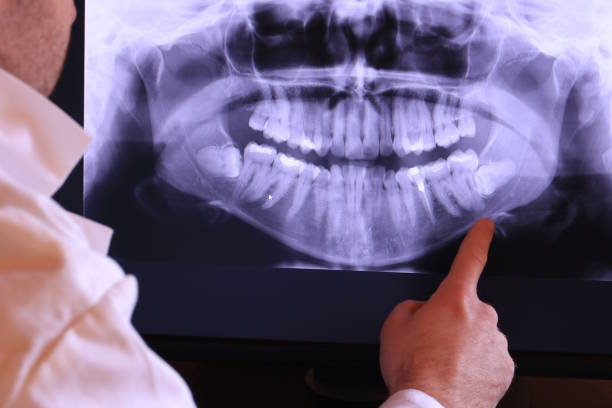 Best Emergency Dental Filling Replacement  in Yoe, PA